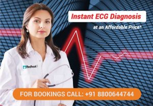 ECG Test at home in Hyderabad